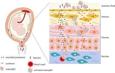 The role of neutrophils in chorioamnionitis